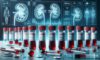Kidney Blood Test Guide: Essential Insights for Blackburn Residents