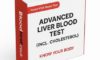 Liver Blood Test Guide for Residents of Maidstone