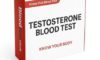 Testosterone Blood Test: Key Details for Birmingham Locals