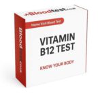 Vitamin B12 Blood Test Guide for NHS Services in Stevenage
