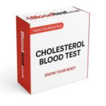 High Cholesterol Blood Test: Essential Insights for Taunton